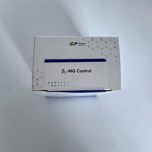 β2-MG