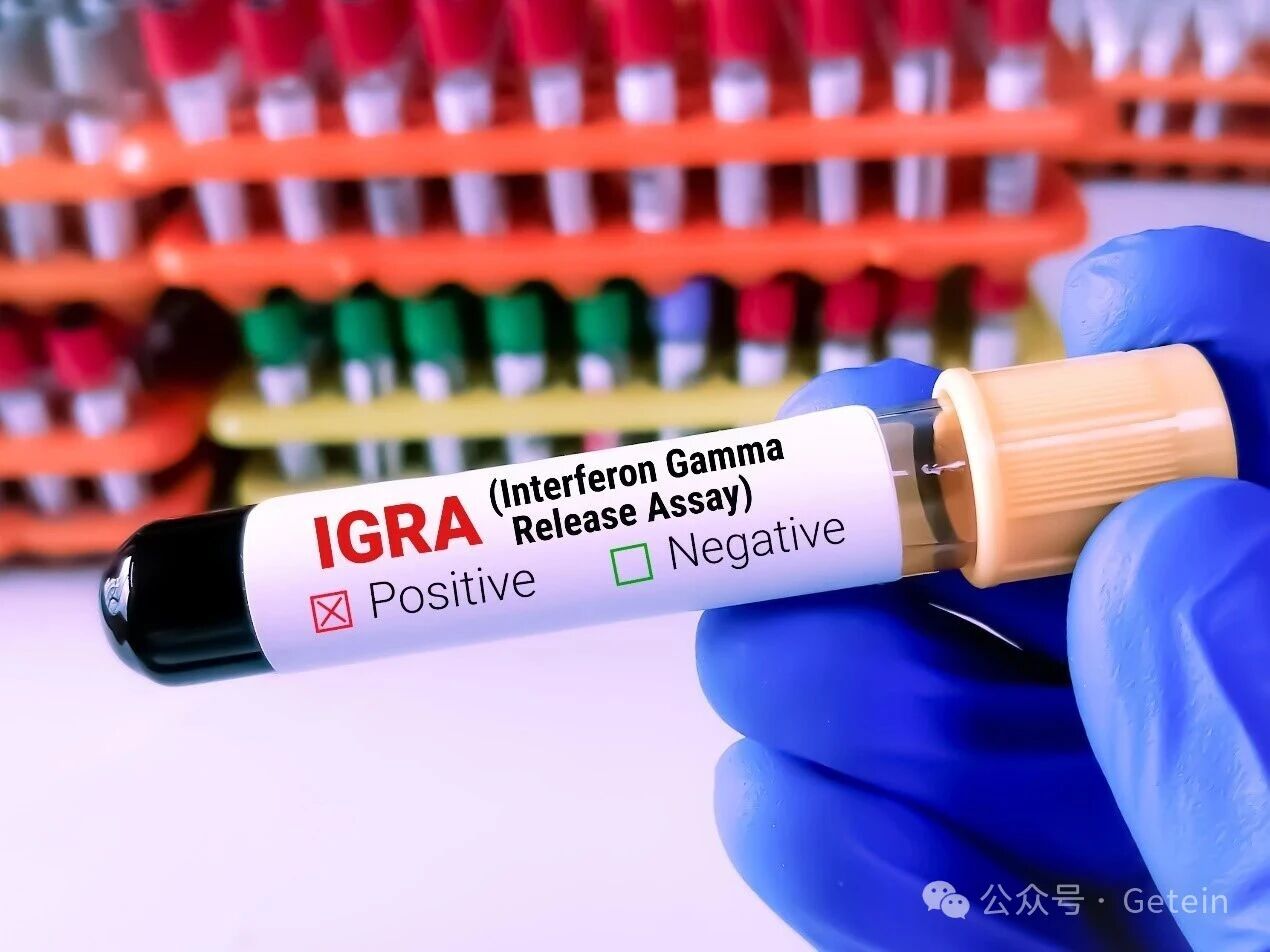 Comprehensive and Accurate TB-IGRA Testing Solution